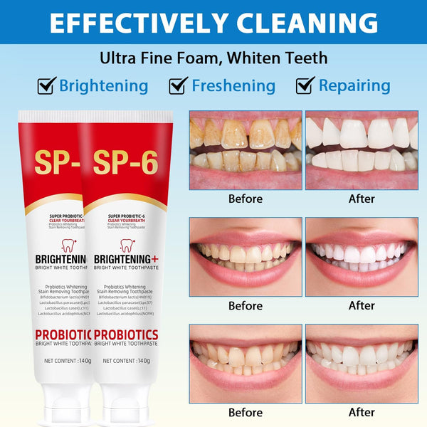 Sp-6 Ultra Whitening Toothpaste – Brightens Your Smile